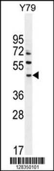 LACE1 Antibody (N-term)