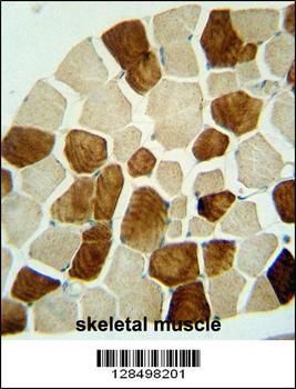 ZSWIM6 Antibody (C-term)
