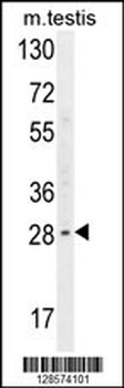 YDJC Antibody (Center)