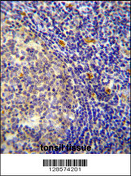 YDJC Antibody (Center)