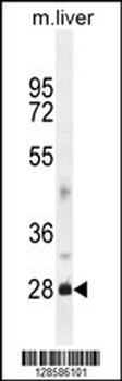 DNAJB8 Antibody (N-term)
