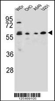 CEP70 Antibody (Center)