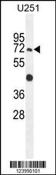GPAA1 Antibody (N-term)