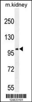 GRIA4 Antibody (Center)