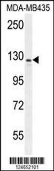 IBTK Antibody (Center)