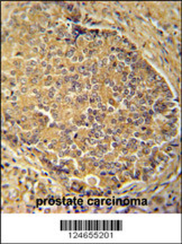 IGSF1 Antibody (C-term)