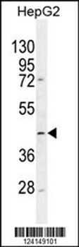 TMLHE Antibody (N-term)
