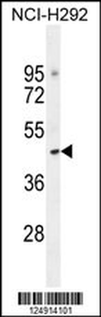 TJAP1 Antibody (N-term)