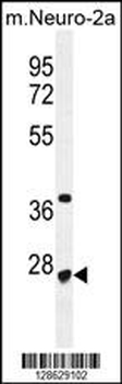 CF153 Antibody (C-term)