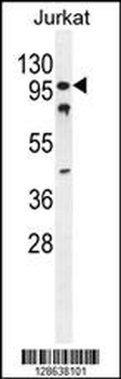 CWC22 Antibody (N-term)