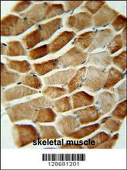 SYNCI Antibody (N-term)