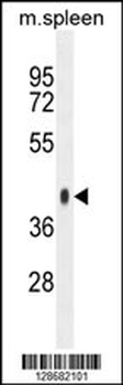 SYTL3 Antibody (N-term)
