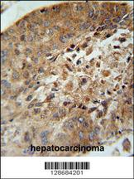 ACD10 Antibody (Center)