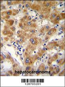 ODF3B Antibody (N-term)