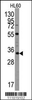 UBTD1 Antibody (C-term G195)
