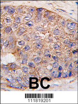 UBTD1 Antibody (C-term G195)