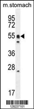 DMRTA1 Antibody (C-term)