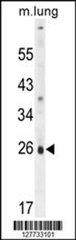 PQLC1 Antibody (Center)