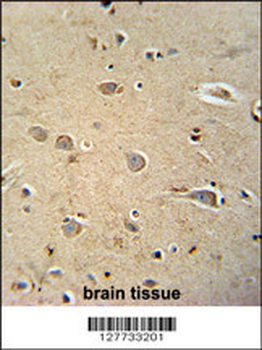 PQLC1 Antibody (Center)