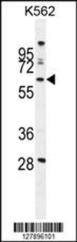 WDR49 Antibody (C-term)