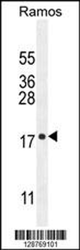 POU2AF2 Antibody (C-term)