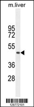 TMEM229A Antibody (Center)