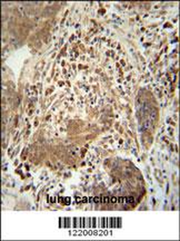 TAGAP Antibody (Center)