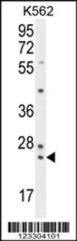 PAUF Antibody (Center)
