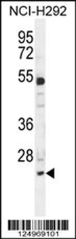 BCL7A Antibody (N-term)