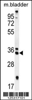 REEP4 Antibody (C-term)