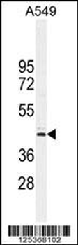 CT112 Antibody (Center)