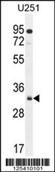 NUSAP Antibody (N-term)