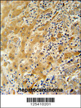 NUSAP Antibody (N-term)