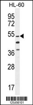 CO044 Antibody (C-term)