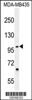 ZNF512B Antibody (C-term)