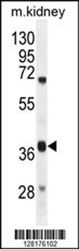 DUS4L Antibody (Center)