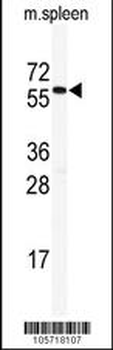 HDAC2 Antibody (C-term)