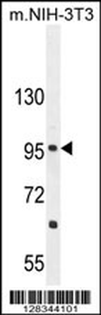 CCDC39 Antibody (C-term)