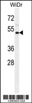 IL1R2 Antibody (Center)