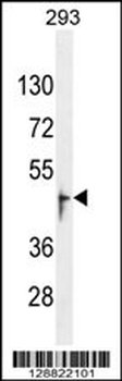 OR13J1 Antibody (C-term)