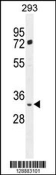 FRG2B Antibody (N-term)