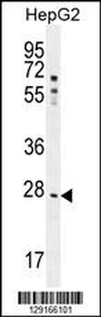 NR0B2 Antibody (Center)