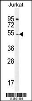 DARS Antibody (N-term)