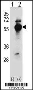 DARS Antibody (N-term)