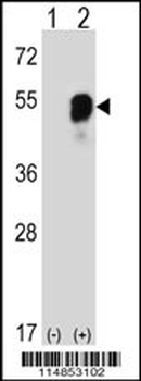 PARS2 Antibody (C-term)