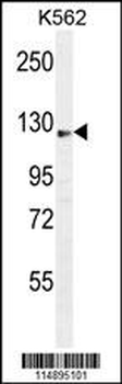 AASS Antibody (C-term)