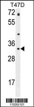 CTSZ Antibody (N-term)