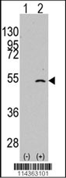 ELP3 Antibody (C-term)