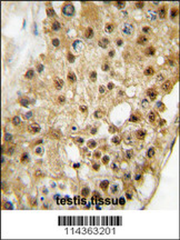 ELP3 Antibody (C-term)