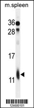 RPL39 Antibody (Center)
